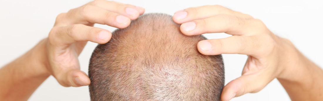 Scalp Massage for Hair Growth, Does it Really Work?